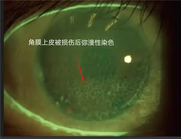 假睫毛狂热者的现状：揭秘他们的新生活