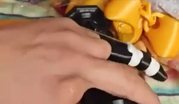 男子用3D打印神器，为舅舅断指重生