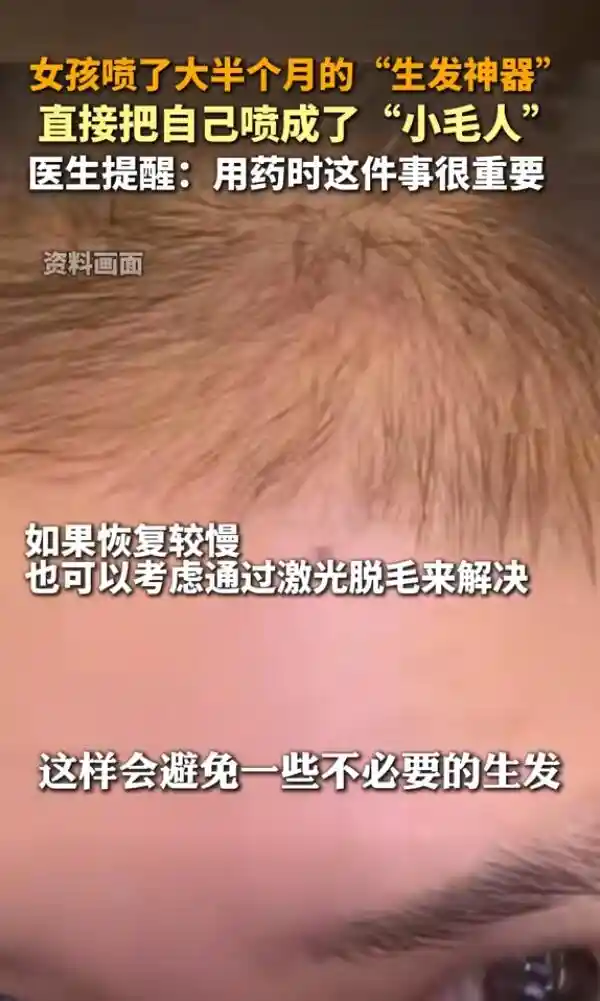 女子使用‘生发神器’变‘小毛人’，真相惊呆众人！
