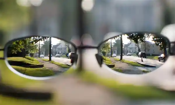 《重获睛彩：近视激光手术患者的真实蜕变之旅》