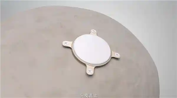 《开启脑控新时代：我国首次成功开展侵入式脑机接口临床试验》