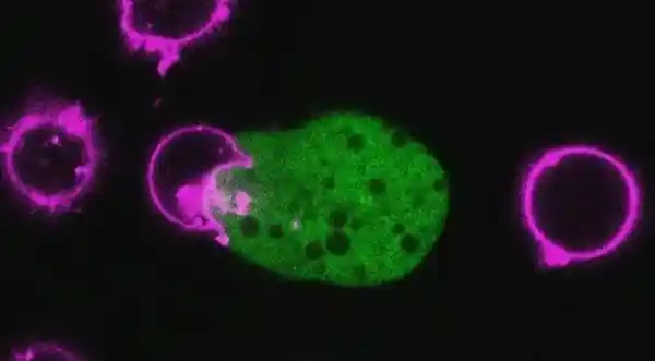 《潜伏的沉默杀手：揭秘每年侵袭5000万人的寄生虫真相》